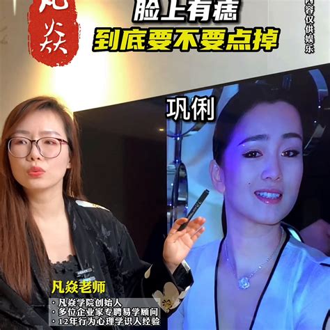 臉部痣|脸上的痣到底要不要祛除？听听专家怎么说